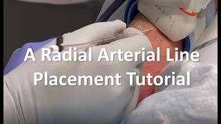 A Radial Arterial Line Placement Tutorial [upl. by Eissac]