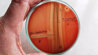 CAMP test for Streptococcus agalactiae  GBS [upl. by Hsiwhem123]