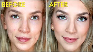 How To Cover Acne Blemishes with Makeup  LeighAnnSays [upl. by Petrie]