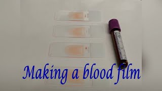 Making a blood film [upl. by Shermie]