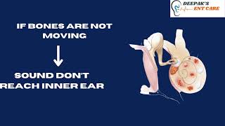 WHAT IS OTOSCLEROSIS [upl. by Nedla795]