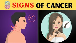 Skin Cancer How to spot melanoma warning signs [upl. by Ayekram]