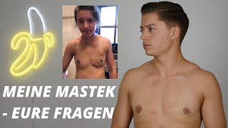 QampA  ich beantworte eure Fragen zu meiner MastektomieBrustoperation  FTM TRANSGENDER [upl. by Brok]