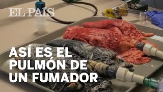 Así se transforma el pulmón de un fumador [upl. by Adnarb]