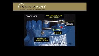 BIOMECÁNICA CON MINI IMPLANTES  7 MESIALIZACIÓN MOLAR CON SPACEJET DE FORESTADENT [upl. by Sloane470]