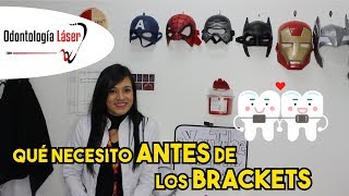 Qué necesito ANTES de los Brackets  Odontología Láser [upl. by Acilef]