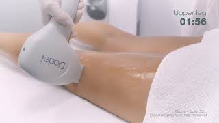 Cocoon Medical PrimeLase HR diode laser treatment time [upl. by Reeher]