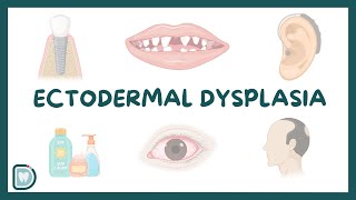 Understanding Ectodermal Dysplasia Causes Diagnosis Types and Management [upl. by Bedad365]