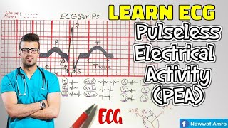 الايقاع الكاذب Learn ECG Pulseless Electrical Activity PEA [upl. by Senga571]