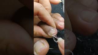 foryou toenails nails footcare toenailfungus foottreatment nailcare podologia pedicure [upl. by Miharbi947]