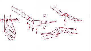 Fracturas Carpo  Ortopedia y Traumatología Clases Qx Medic  10 [upl. by Einej]