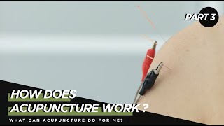 Understanding Acupuncture Part Three What can acupuncture do for me [upl. by Tocci419]