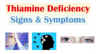 Thiamine Vit B1 Deficiency Signs amp Symptoms amp Why They Occur [upl. by Stanford]