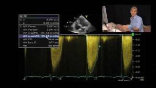 LowFlow Aortic Stenosis [upl. by Heigl]