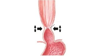 DEVELOPMENT OF FOREGUT amp ANOMALIES  Part2 [upl. by Elagiba]