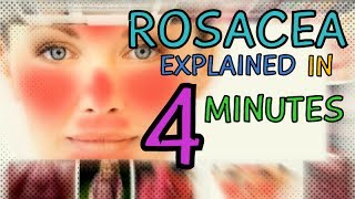 ACNE ROSACEA  ROSACEA EXPLAINED IN 4 MINUTES  TYPES OF ROSACEA  CAUSES  TREATMENT OF ROSACEA [upl. by Ihab]