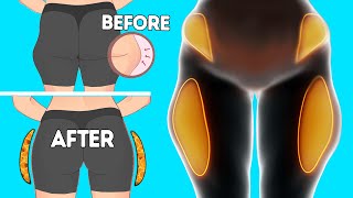 SADDLEBAGS FAT  LOSE OUTER THIGH FAT IN 2 WEEKS  FAST RESULTS [upl. by Wolfgram108]