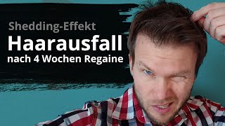 I hab Haarausfall  Ebbser Kaiserklang [upl. by Corbet]