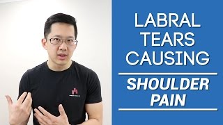 Shoulder pain from labral tears Is the labrum really the problem [upl. by Burris]