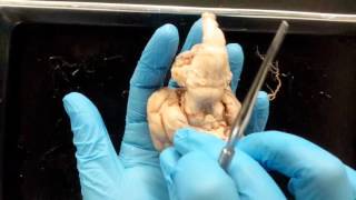 Sheep Brain Dissection [upl. by Beale]