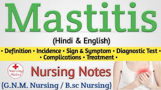 Mastitis  Mastitis In Hindi Nursing Lecture [upl. by Cleodell]