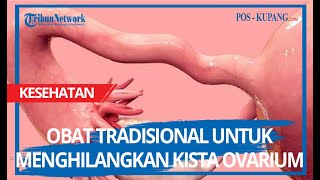 Obat Tradisional Untuk Menghilangkan Kista Ovarium [upl. by Anahtor]