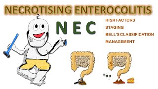 NEC  Necrotizing enterocolitis NEONATOLOGY SERIES CH6 [upl. by Acquah726]