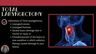 NCM 71 Video  cervical esophagectomy total laryngectomy total thyroidectomy [upl. by Gervase]