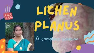 skin problem solutions in tamil home remedy for lichen planus in tamil how to treat lichen planus [upl. by Sucramd18]