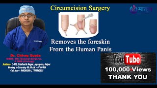 Circumcision Surgery Benefits  Circumcision Procedure Step By Step [upl. by Eglantine]