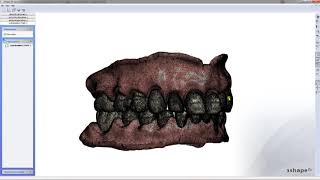 3Shape 3D Viewer Digital Full Dentures [upl. by Silden]