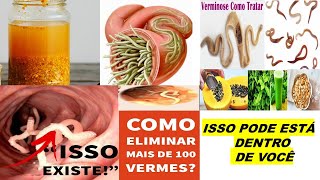 ELIMINE 100 VERMES RÁPIDO VÁRIOS TIPOS 7 RECEITAS CASEIRAS P VERMINOSE ADULTO E CRIANÇA [upl. by Nobell]