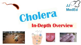 Cholera Vibrio Cholerae Pathophysiology Risk Factors Symptoms Diagnosis and Treatment [upl. by Divod900]