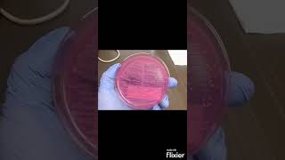 Escherichia coli E coli on MacConkey agar MAC  Clinical Microbiology shorts [upl. by Yelekalb868]