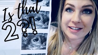 7 WEEK PREGNANCY UPDATE ULTRASOUND  GUARDING MY HEART amp TWINS [upl. by Ahsiri]