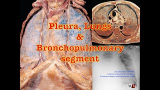 Pleura Lungs amp Bronchopulmonary segments BSCBN nursing [upl. by Eittap]