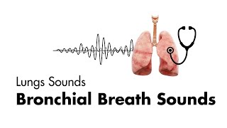 Bronchial Breath Sounds  Lung Sounds  Medzcool [upl. by Phail]