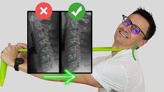 Best Exercise to Fix Loss of Neck Curve cervical lordosis or Military Neck  Dr Jon Saunders [upl. by Walden]