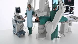 Dr Baker  Infinixi 5Axis Clinical Advantages [upl. by Aivlis215]