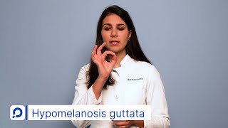 Hypomelanosis guttata  Hypo vs Hyperpigmentierung  dermanostic Hautlexikon [upl. by Sloan830]