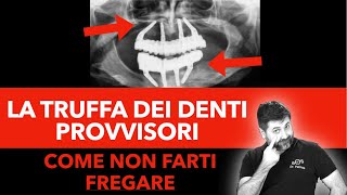 Protesi dentale fissa La Truffa dei Denti provvisori [upl. by Middendorf99]