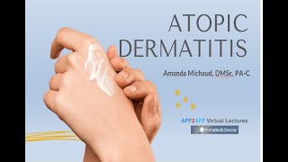 Atopic Dermatitis [upl. by Maurili]