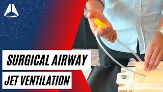 Jet Ventilation for CICO Emergencies  Airway Management [upl. by Stafani]