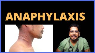 Anaphylaxis Causes Clinical features Management [upl. by Hank]