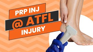 UltrasoundGuided PRP Injection for Speedy Recovery from ATFL Ankle Injury 📽️ [upl. by Fennie]