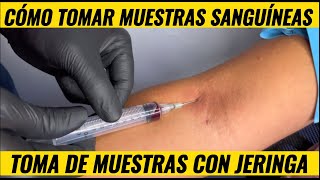 Como tomar muestras de sangre con jeringa [upl. by Llerat]