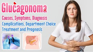 Glucagonoma definition causes symptoms diagnosis complication treatment options and prognosis [upl. by Ruggiero535]