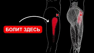 БОЛИТ БОКОВАЯ ПОВЕРХНОСТЬ БЕДРА И ТАЗОБЕДРЕННЫЙ СУСТАВ 🔴 НАПРЯГАТЕЛЬ ШИРОКОЙ ФАСЦИИ БЕДРА [upl. by Iaw965]