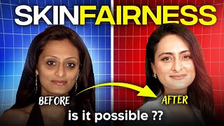 Fairness cream  Do they work  How to lighten skin tone  Dermatologist [upl. by Dara703]