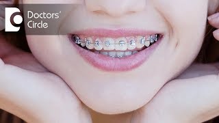 How to close the gap between upper amp lower front teeth  Dr Aniruddha KB [upl. by Ainna232]